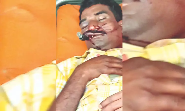 After death of girl, man injured badly due to rough hill road