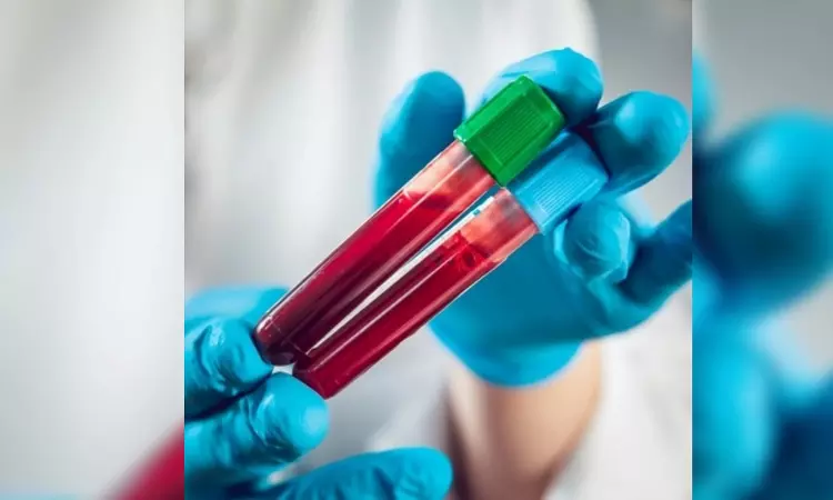 New blood test to detect 50 types of cancer shows promise New blood test to detect 50 types of cancer shows promise