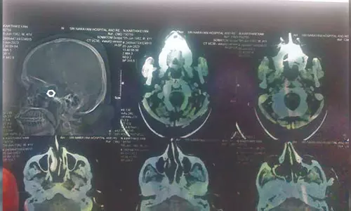 Nut in driver’s skull: Kin blame Vellore GH