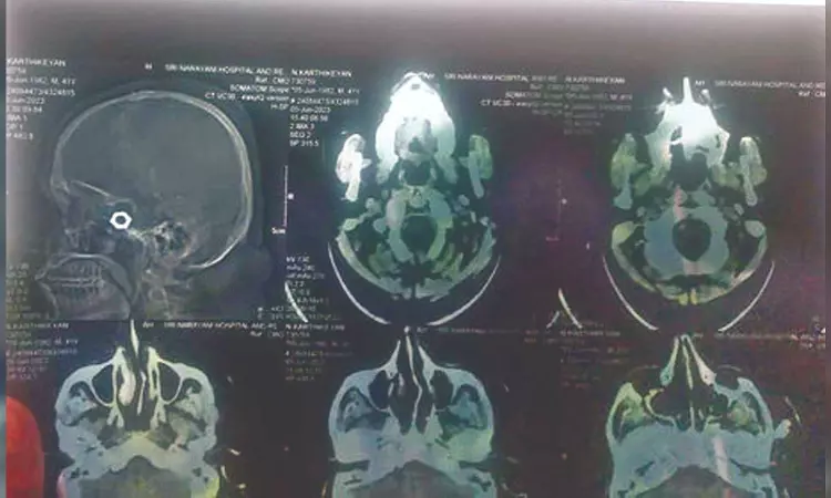 Nut in driver’s skull: Kin blame Vellore GH Nut in driver’s skull: Kin blame Vellore GH