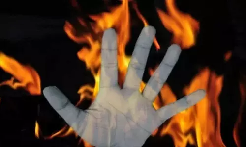 Thiruvallur: Teen succumbs to burns 3 weeks after dress caught fire near temple