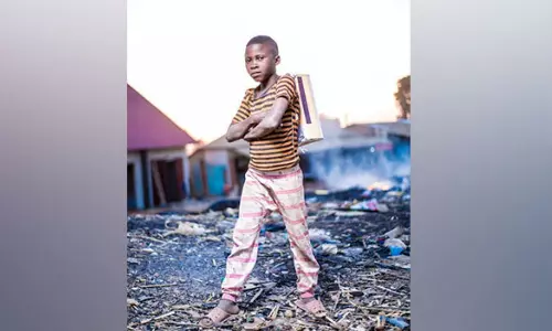 Children who live close to busy roads are more likely to get atopic dermatitis: Study