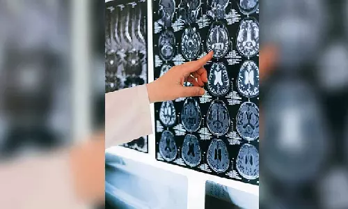 New MRI technique reveals changes in brain post-Covid infection
