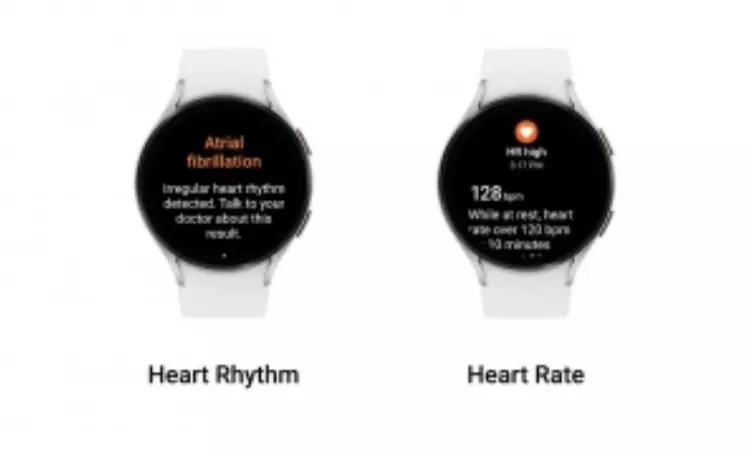 Samsung Galaxy Watches to soon alert users of irregular heart rhythms