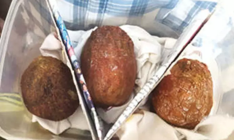 Tusker pearls seized in Kodambakkam Tusker pearls seized in Kodambakkam