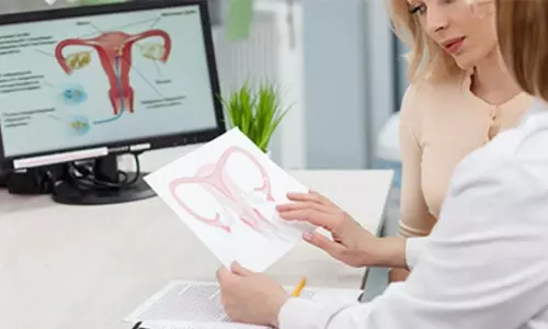 PCOS may double risk of ovarian cancer after menopause: Study