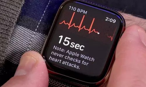 Man credits Apple Watch fall detection for saving his life