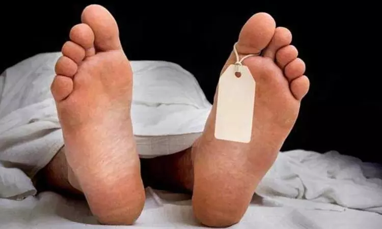 Couple found dead with head injuries Couple found dead with head injuries