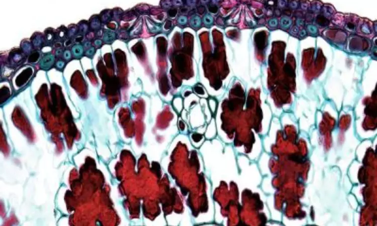 Base editing can be preferable in curing sickle cell disease: Study
