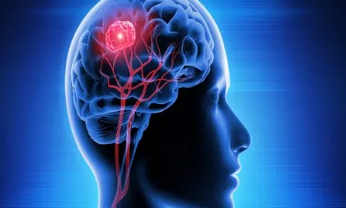 Study discovers how brain processes, stores words that we hear