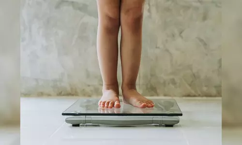 Racial discrimination increases risk for childhood obesity: Study