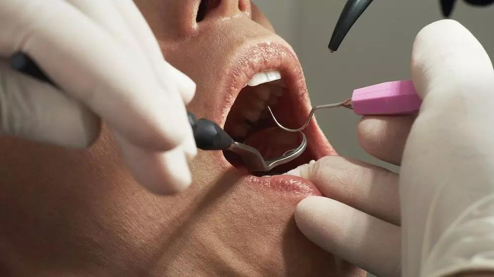 The link between tobacco and oral health care The link between tobacco and oral health care