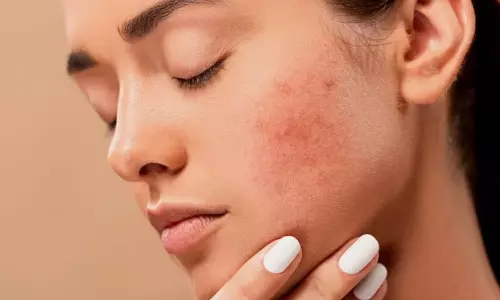 Sudden surge in skin allergies, infections has city docs worried