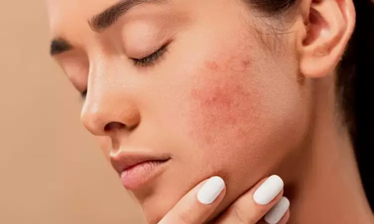 Sudden surge in skin allergies, infections has city docs worried