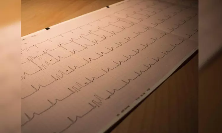 High level of protein used to exclude heart attack may signal risk of death High level of protein used to exclude heart attack may signal risk of death