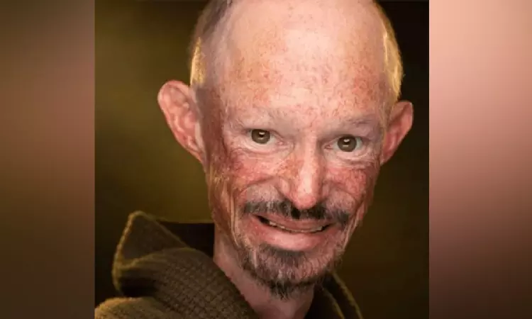 Game of Thrones actor Darren Kent passes away