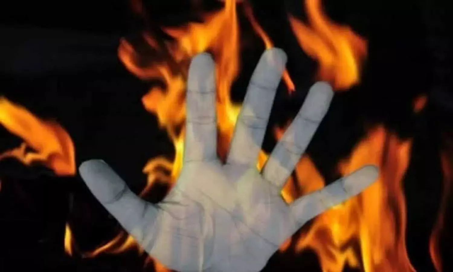 Realtor immolates self demanding help from sister to bail him from business loss