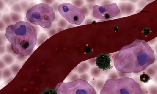 Study offers hope to head & neck cancer patients resistant to chemotherapy