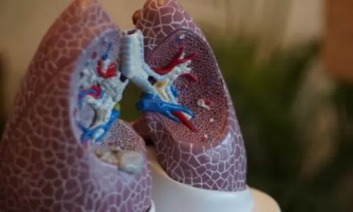 Transplanting patients own lung cells shows promise for people with COPD