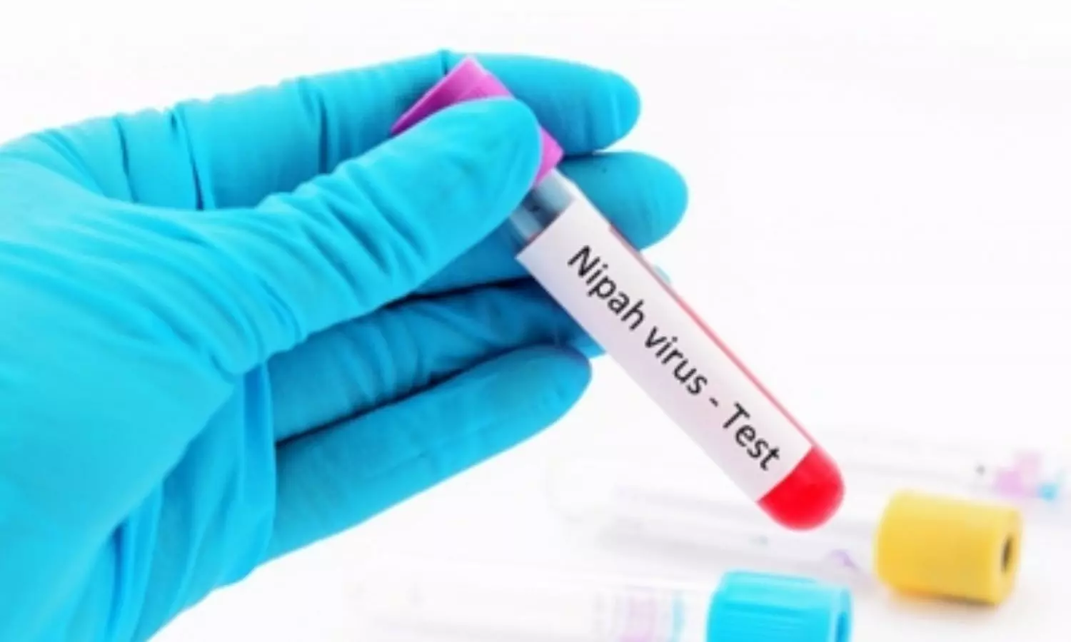 Nipah can spread by droplets, has a fatality rate of 40 to 70%: ICMR