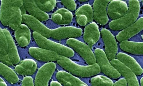 US woman loses all 4 limbs due to bacterial infection from fish