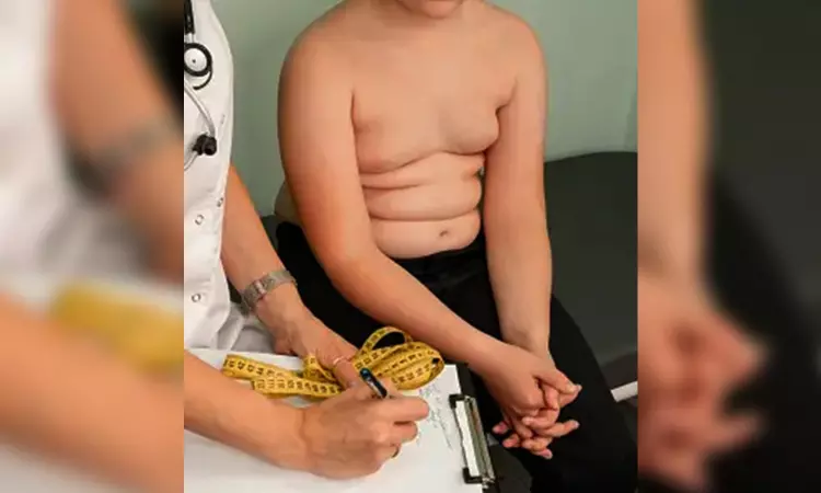 Early treatment may help curb child obesity: Study Early treatment may help curb child obesity: Study