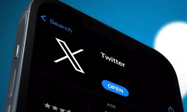 Audio and video calls arriving on X only for premium users