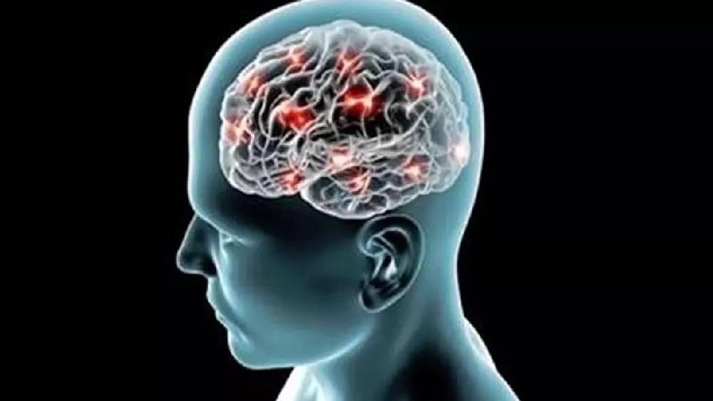 New headband to catch early signs of Alzheimers while you sleep