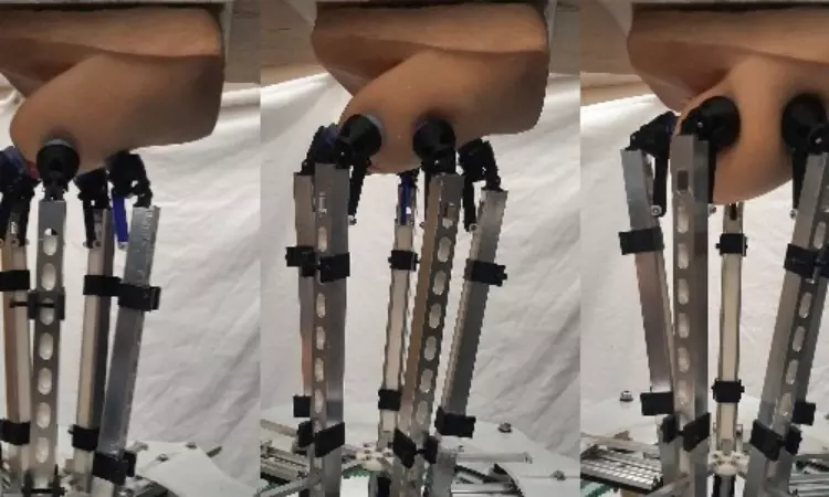 New robot could help diagnose breast cancer early New robot could help diagnose breast cancer early