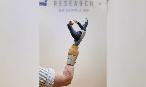Bionic hand, merged with womans nervous & skeletal systems, functional after years