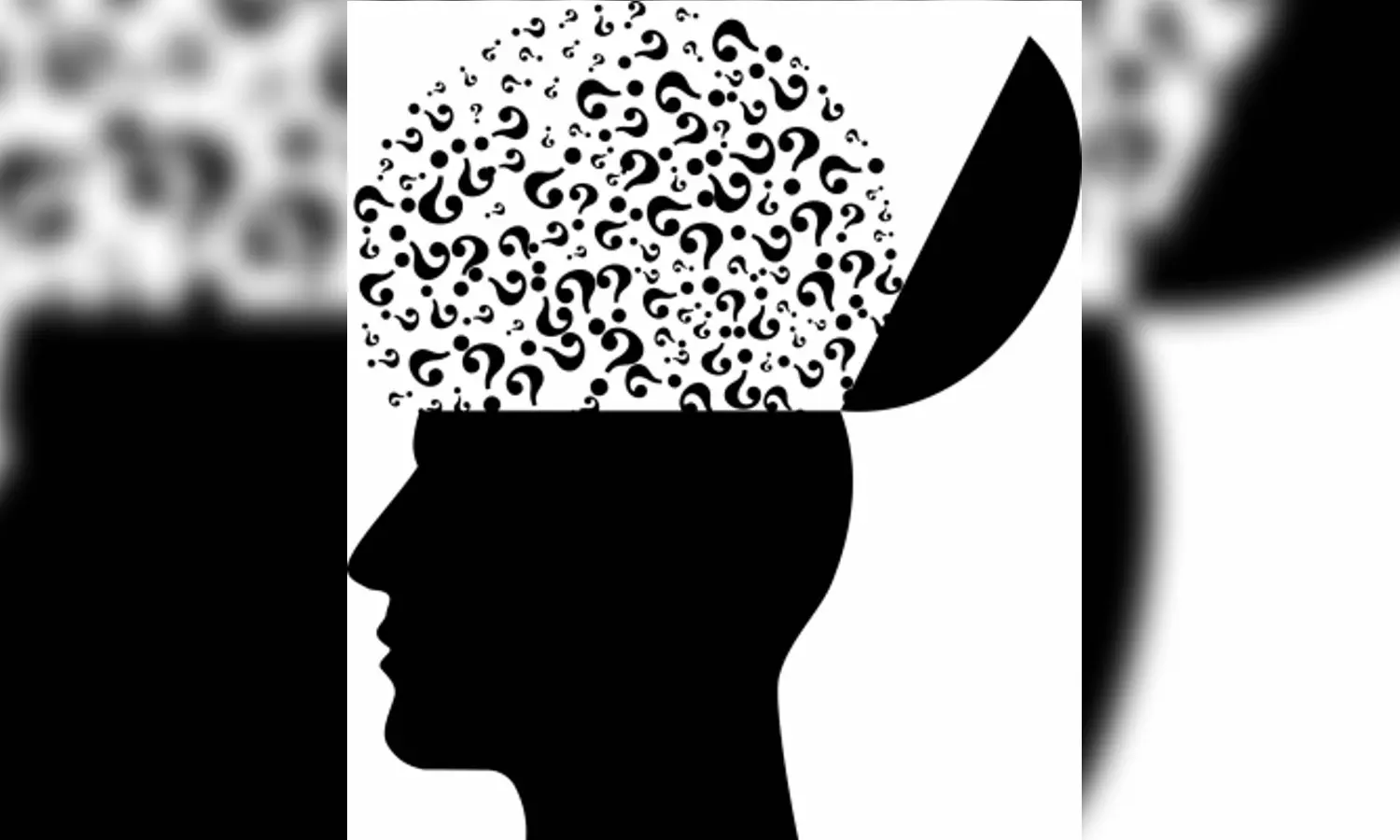 Researchers unravel Alzheimers link with gut microbiota Researchers unravel Alzheimers link with gut microbiota