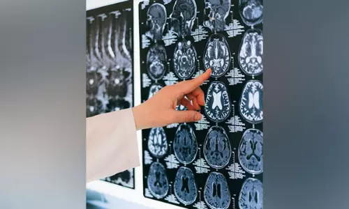 New study could help understand neural underpinnings of schizophrenia New study could help understand neural underpinnings of schizophrenia