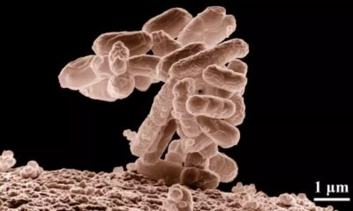 College cafeteria tables carry 60K times more bacteria than toilet seats: Study