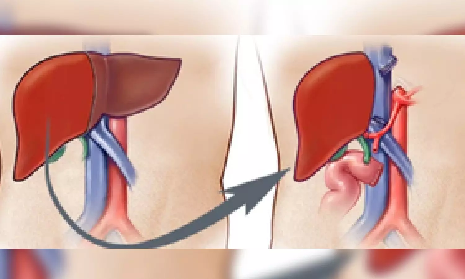 On Dassehra, deceased Mumbai man’s organs give new life to three patients