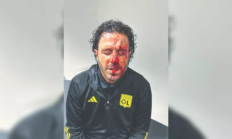 French government condemns ‘disgusting’ Marseille fan violence