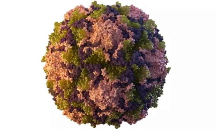 Polio virus found in environmental sample in Karachi