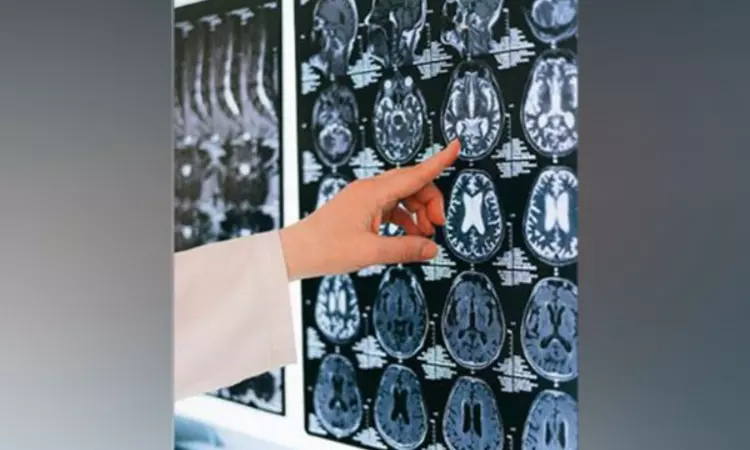 Researchers find how climate change could affect brain