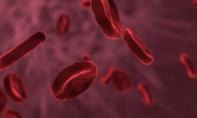 UK approves world’s 1st gene therapy to treat sickle-cell, thalassemia
