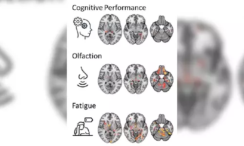 New MRI study reveals how brain changes in long-Covid patients