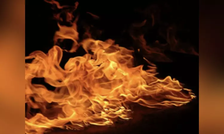 Schoolboy trying to set fire to beehive suffers burns Schoolboy trying to set fire to beehive suffers burns