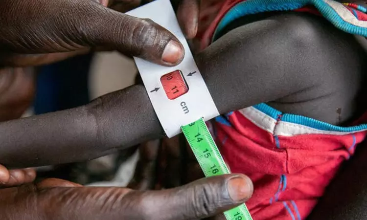 UN decries extreme levels of food insecurity, malnutrition in South Sudan UN decries extreme levels of food insecurity, malnutrition in South Sudan