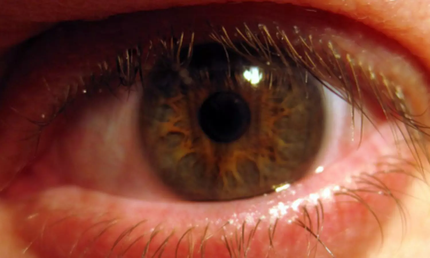 To address diabetic retinal issues, four more districts in TN to get mobile ophthalmic units