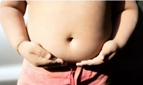 79% Americans think surgery for weight loss should be last resort