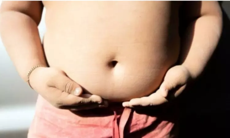 79% Americans think surgery for weight loss should be last resort