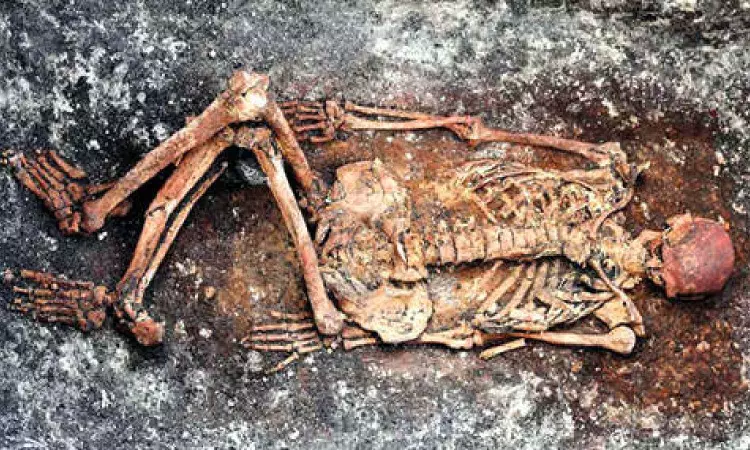 Past skeletons give clues to modern medical mysteries Past skeletons give clues to modern medical mysteries