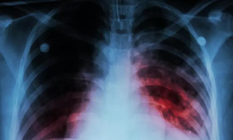 More diabetics died during pandemic, women & children more affected: Lancet