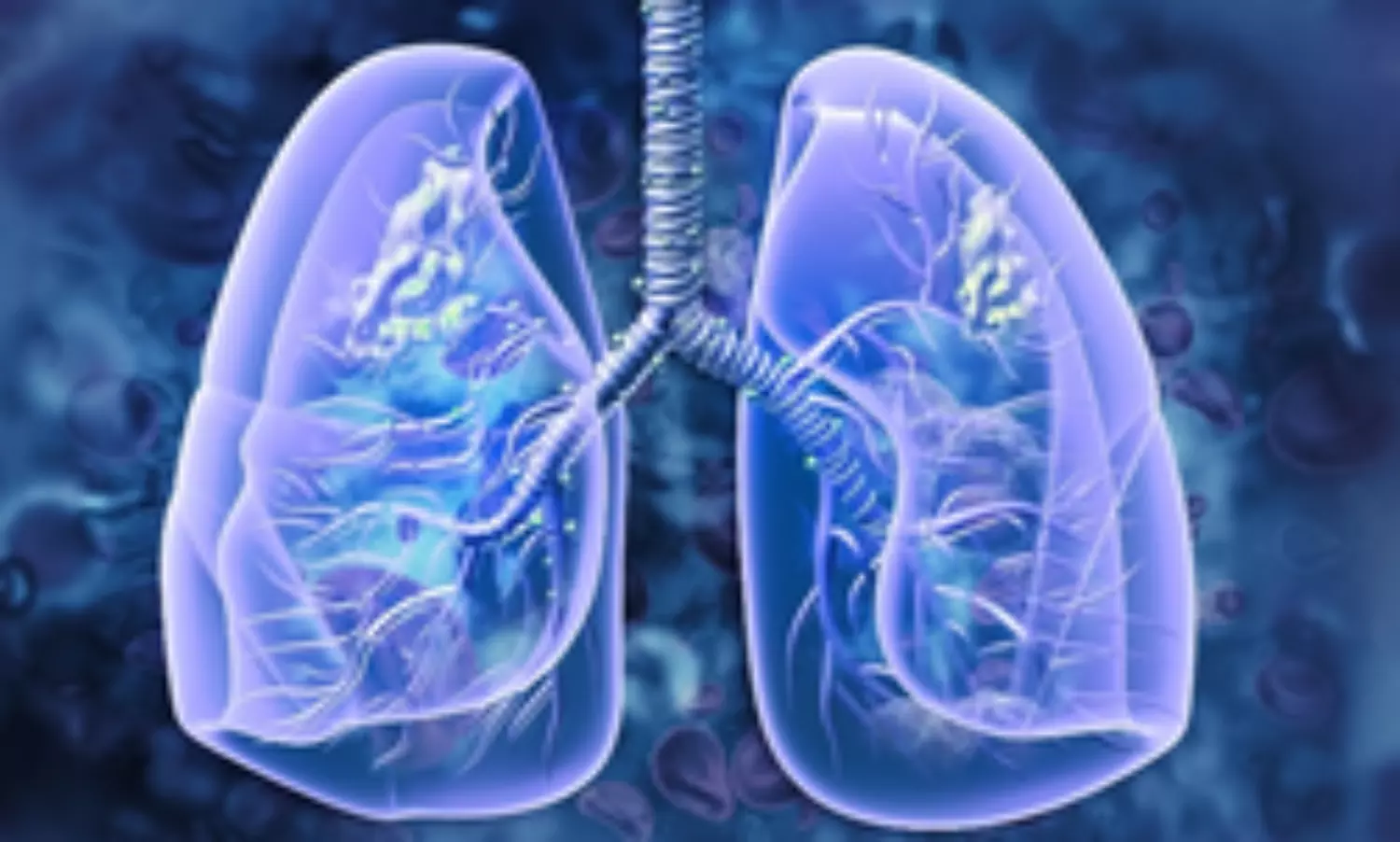 Covid deaths may be linked to a fatal lung disease: Scientists