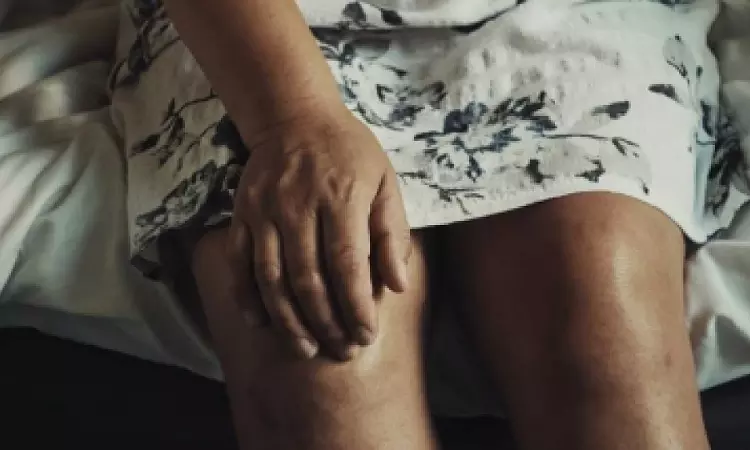 Can rheumatoid athritis raise risk of cancer?