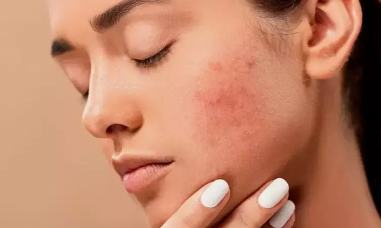 Experts emphasize on making allergy testing more accessible