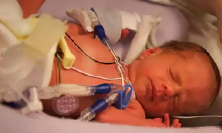 Why kids conceived post IVF face low birth weight risk Why kids conceived post IVF face low birth weight risk